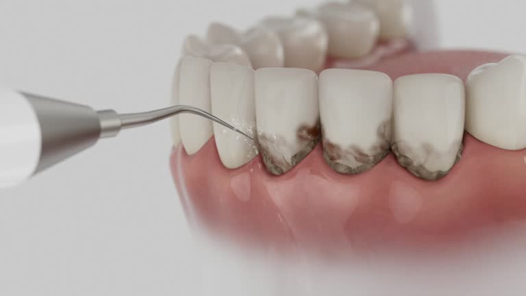 Trusted Dental Implants service in Anahuac, TX - Dentist Open Now